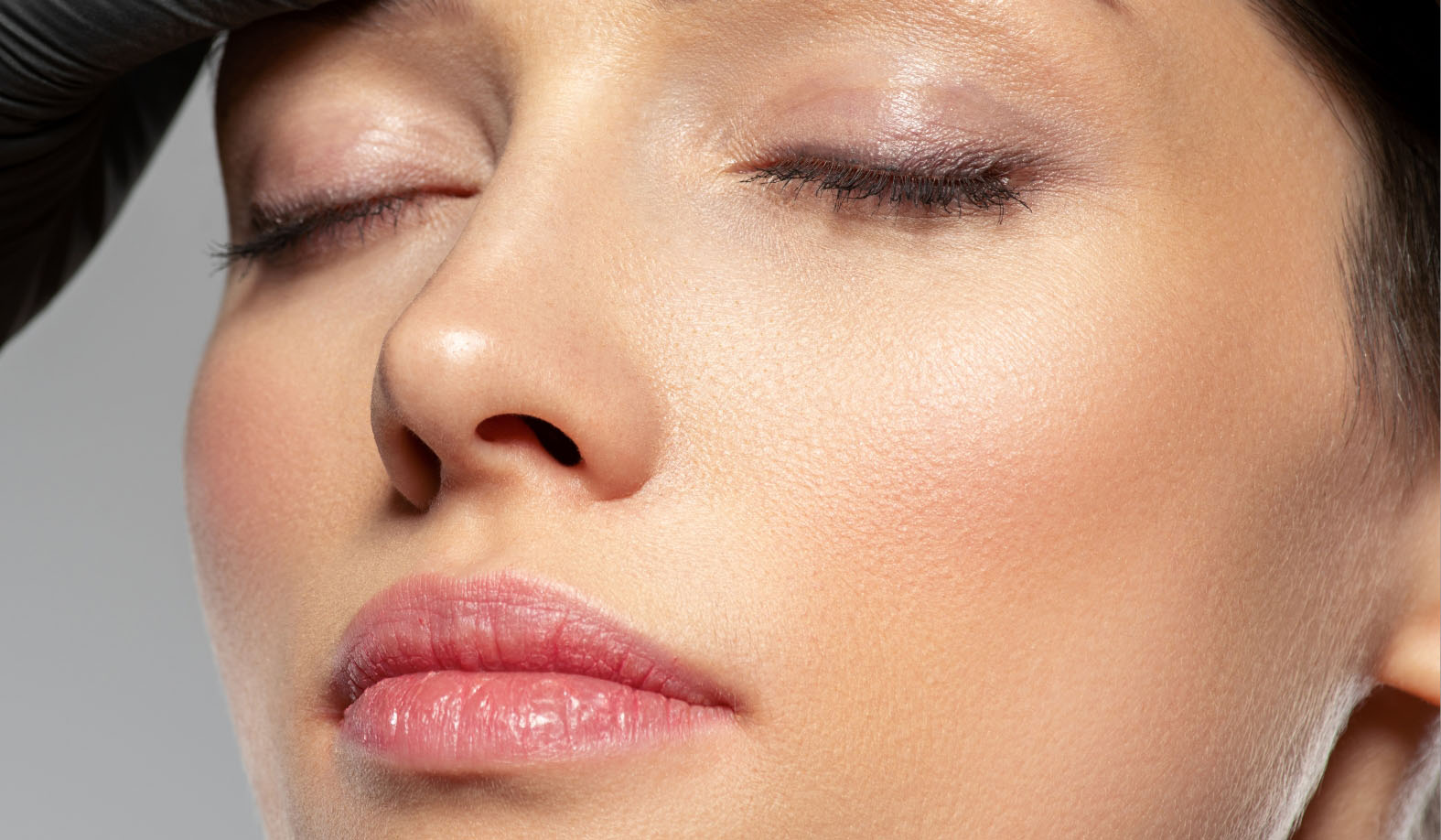 Cheek Volume Restoration