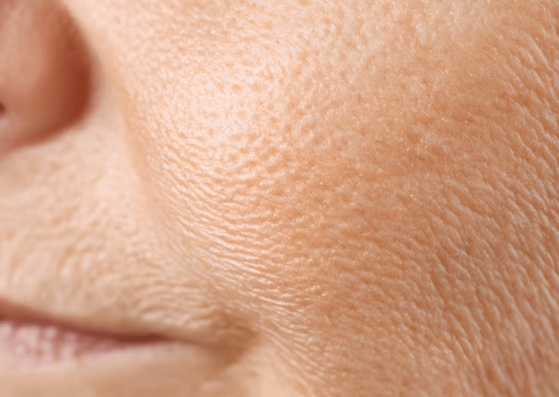 Ageing & Wrinkles
