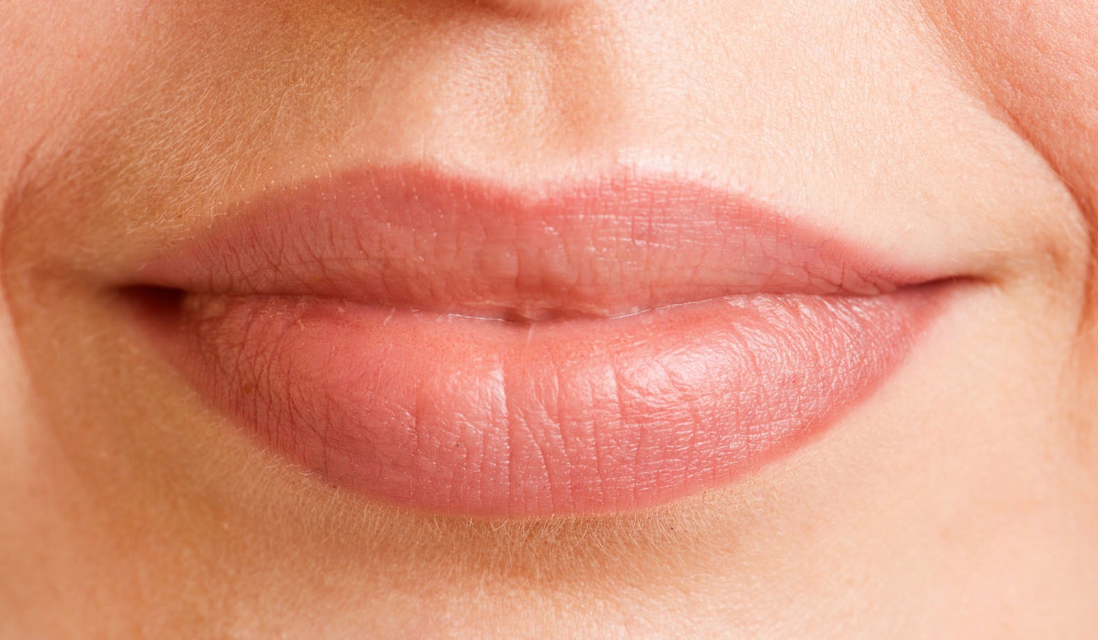 Perioral Line Softening