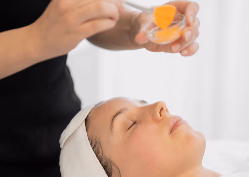 Skin Peels