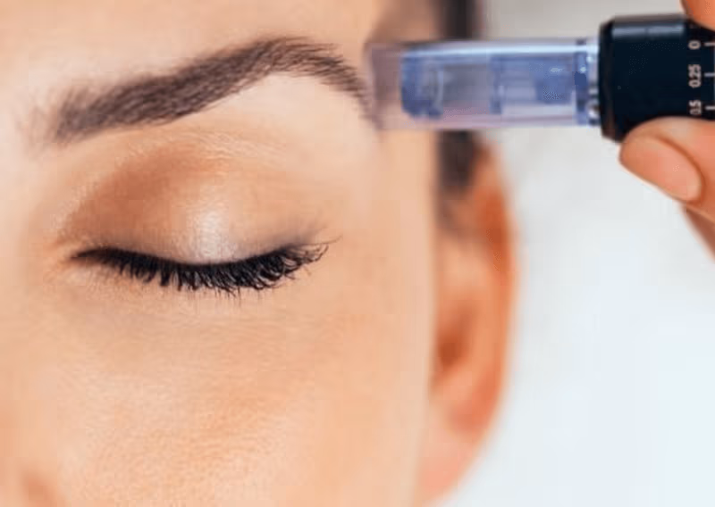Skin Needling