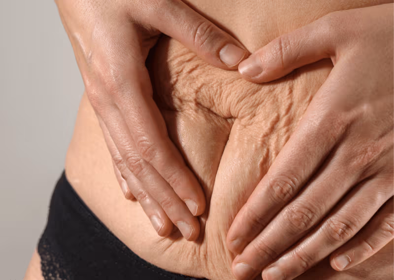 Lax Skin & Loss of Elasticity