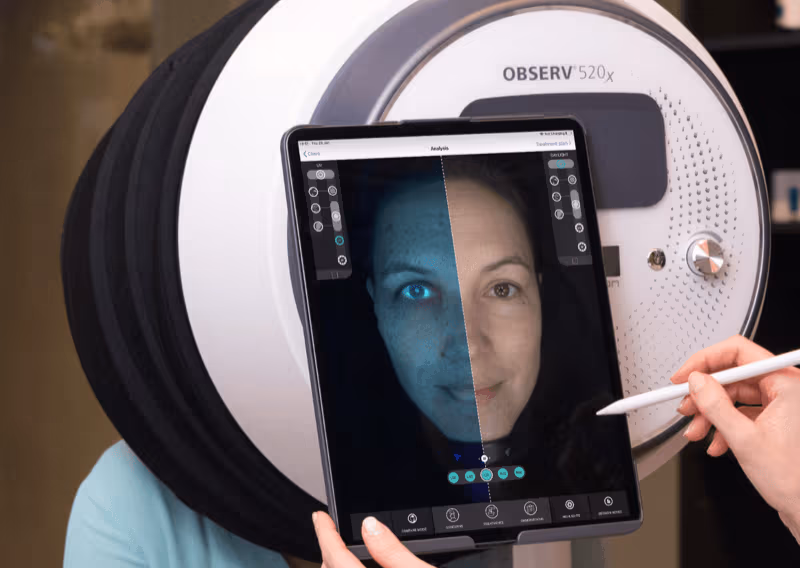 Observ Skin Analysis