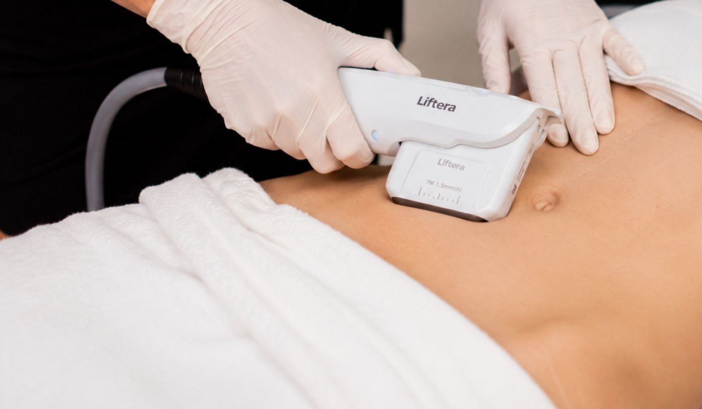 HIFU Full Abdomen Lift