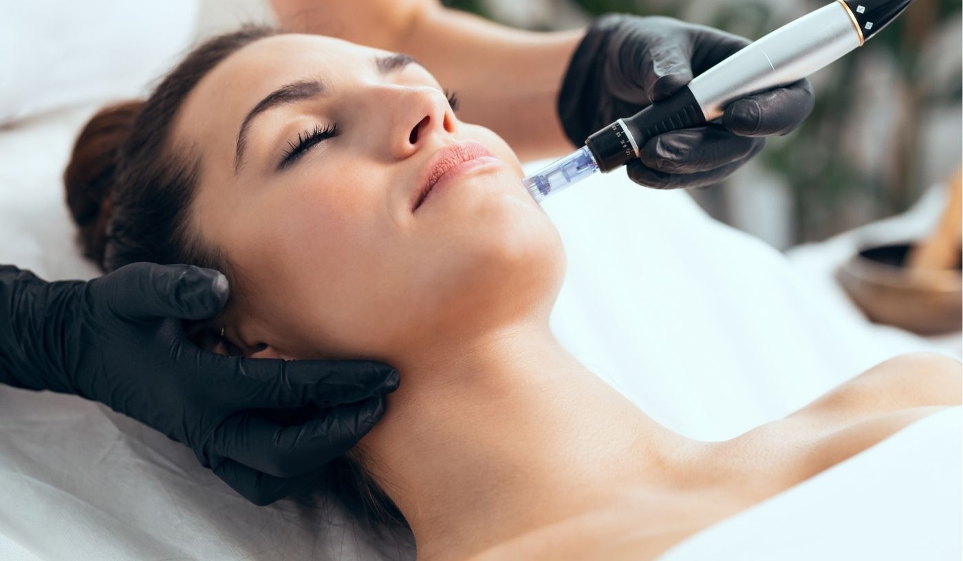 Cellular Boost Needling + Peel