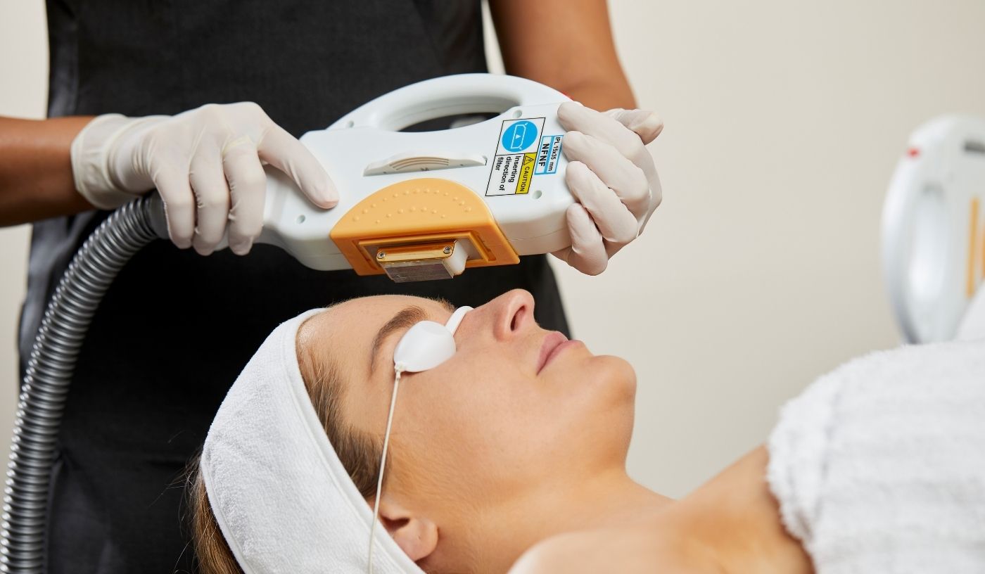 IPL Pigment Zone Correction (+10 Lesions)