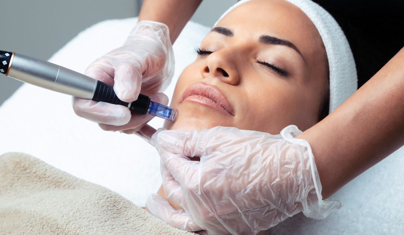 Rejuvenate Meso Infusion Needling