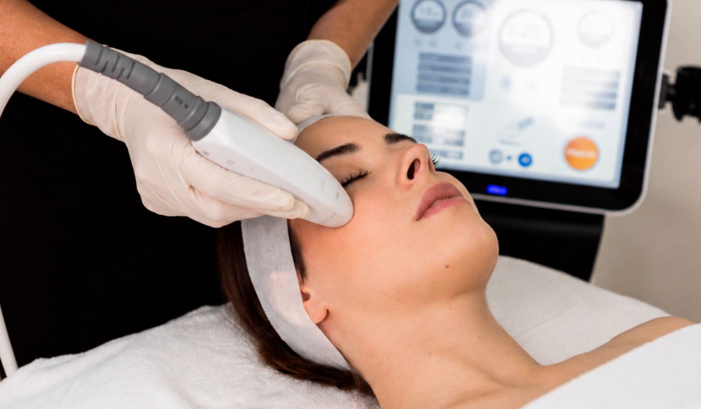 HIFU Fox Eye lift (Upper Half Face)