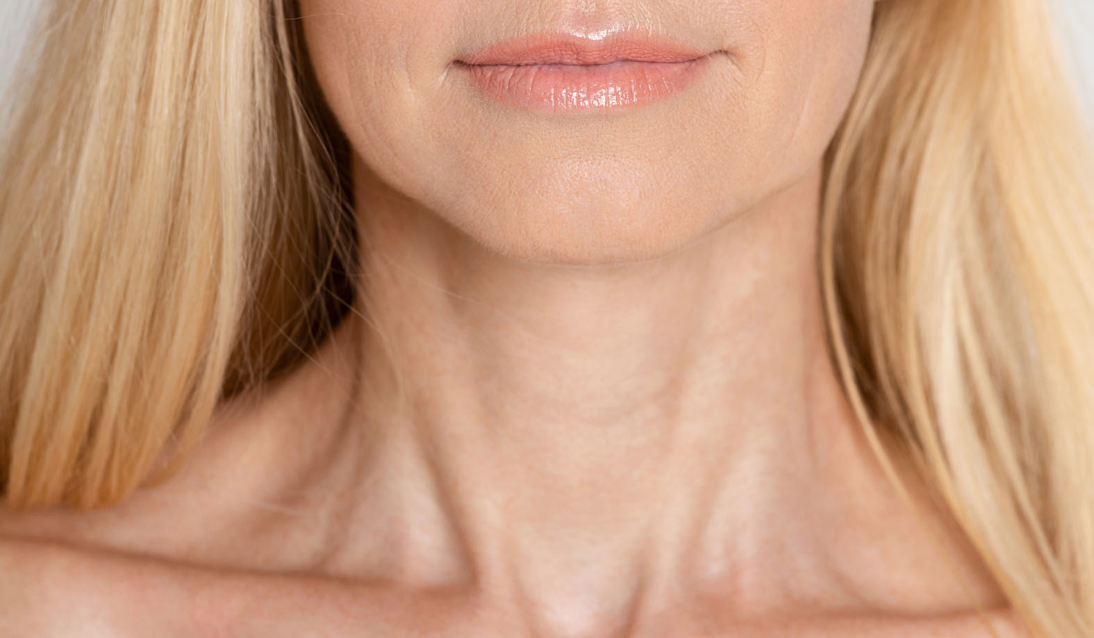 Platysmal Bands / Neck Lines
