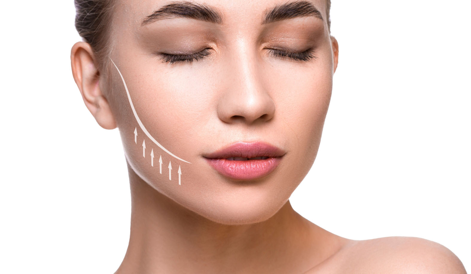Mid-Face Lift (Thread)
