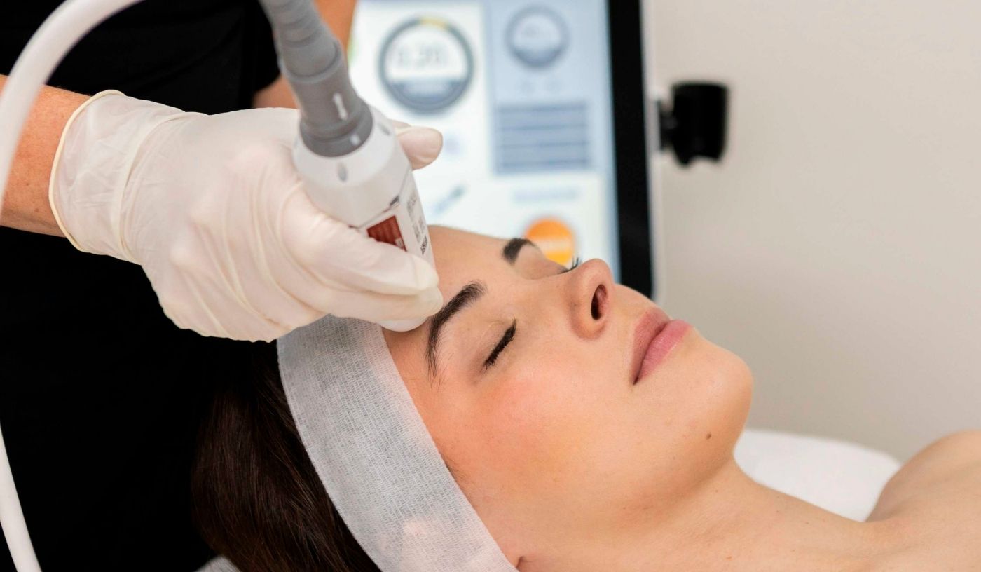 HIFU Brow Lift (Hooded Eyes)