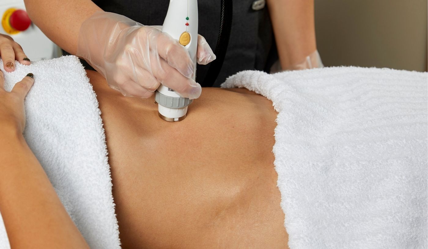 RF Tummy Tighten